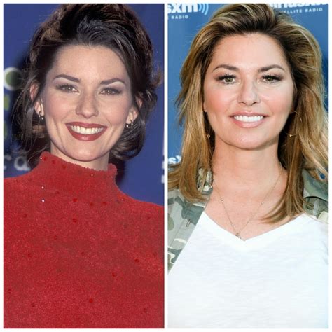 what happened to shania twain face